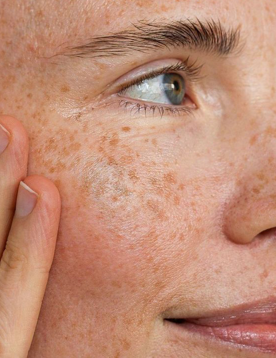 Top Ingredients for Sensitive Skin (and What to Avoid)